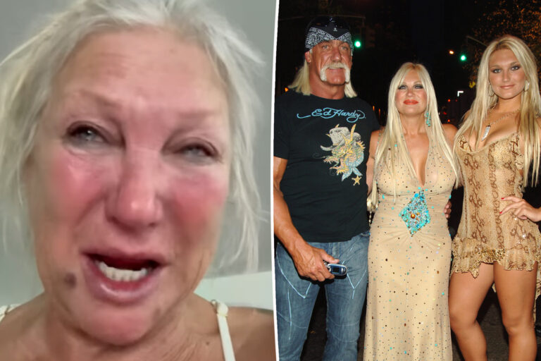 Hulk Hogan’s ex-wife Linda claims ‘narcissist’ daughter Brooke broke her collarbone in drunken scuffle